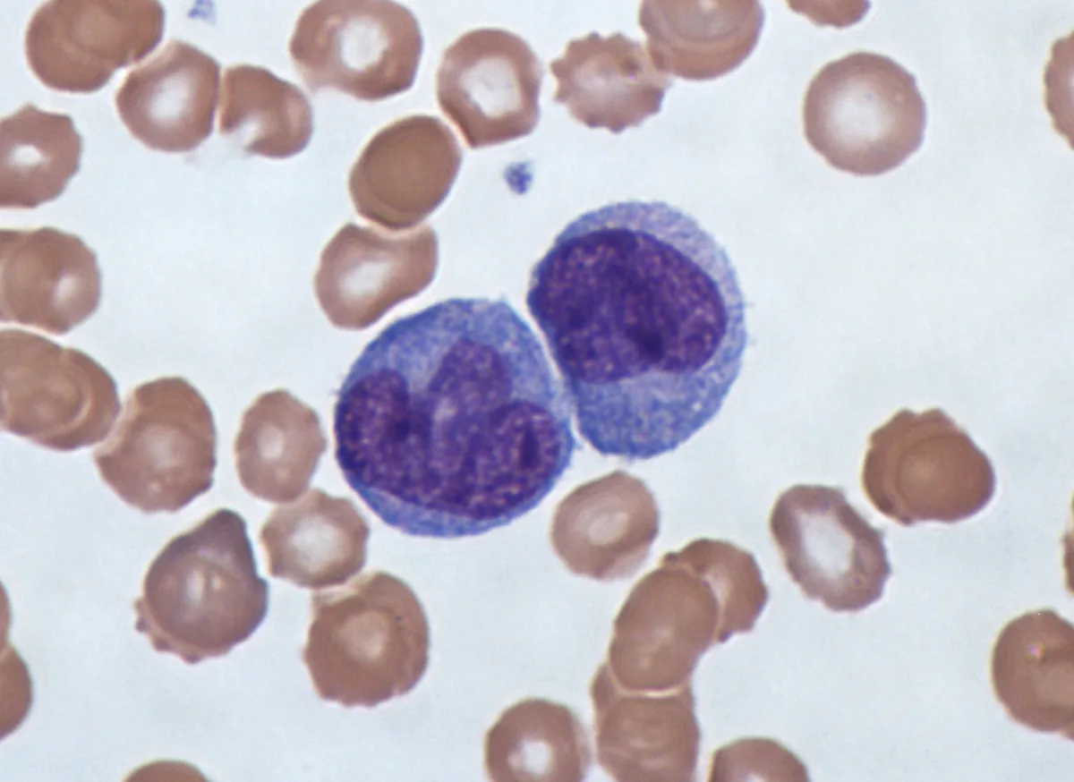 Frotis de sangre humana visto al microscopio: los discos rosados son glóbulos rojos; las dos células moradas y más grandes, con núcleo teñido, son glóbulos blancos. De los cuatro componentes de la sangre, el glóbulo blanco es el único con la defensa como oficio. Fotografía de Dr Graham Beards, Wikimedia Commons, CC BY-SA.