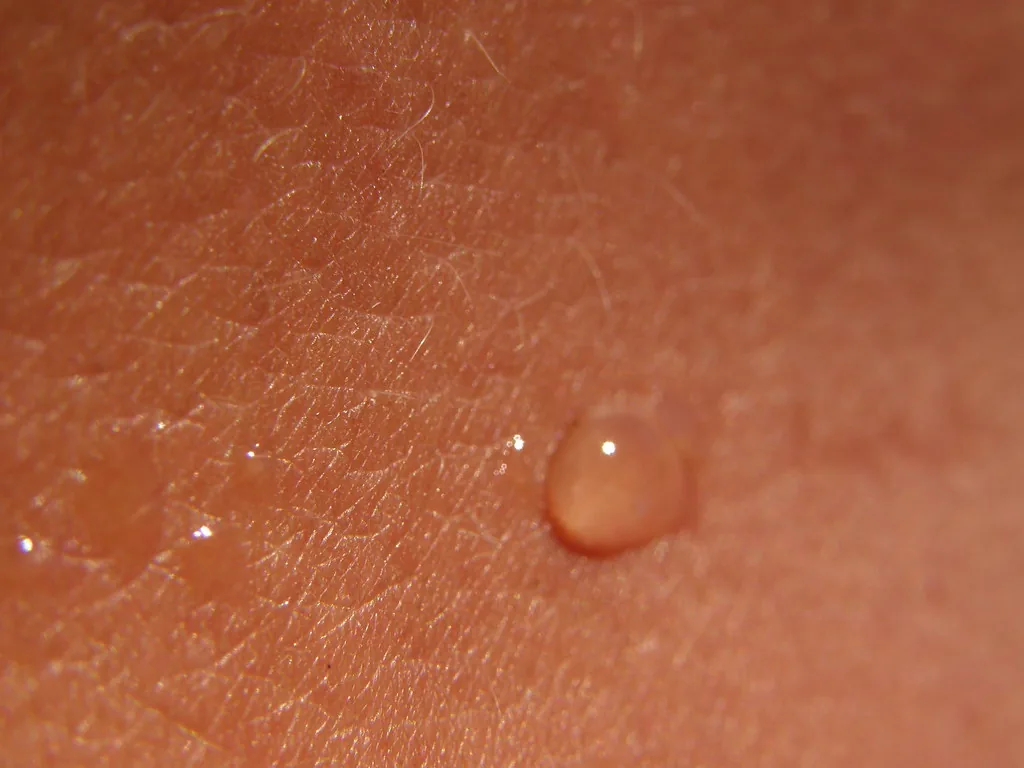 Piel humana vista muy de cerca, con una gota de sudor y los vellos que salen de ella. El sudor no llega de otra parte: lo fabrican glándulas que están en la piel misma, y al evaporarse se lleva calor, que es la forma en que el cuerpo baja su temperatura. Fotografía de Jo Andre Johansen, publicada en Flickr con licencia Creative Commons BY-SA.